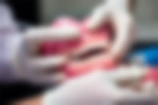 全瓷牙的起源年份是什么时候？了解全瓷牙的历史与发展历程
