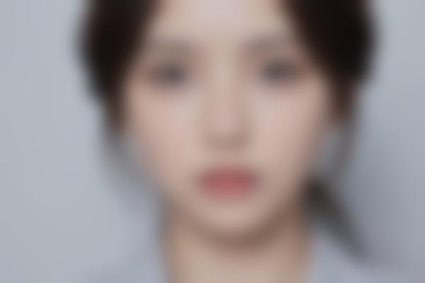 为什么脸上总长痘痘？这5个原因你可能每天都在做