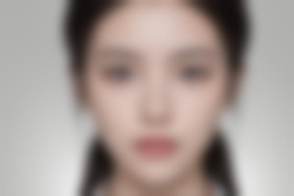 APUE毛发移植靠谱吗？真实解析技术原理与