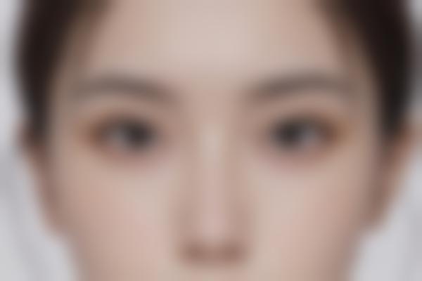 手臂吸脂和手臂提升术有什么区别？医生详解手臂整形方案