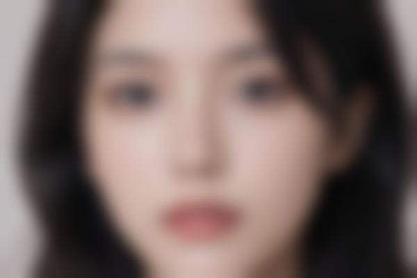 激光美容：科学焕肤的秘密，的现代选择