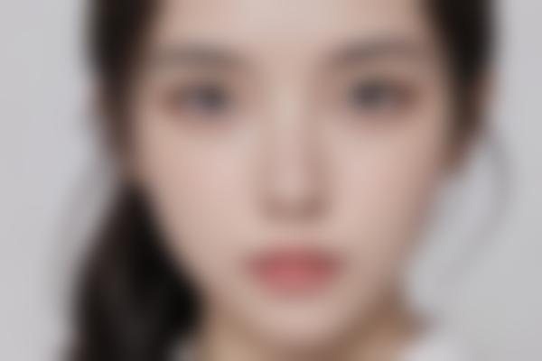 如何有效治疗皱纹？这5种方法值得尝试
