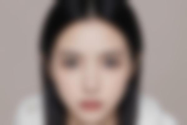 五官整形如何选择？这份指南帮你避坑