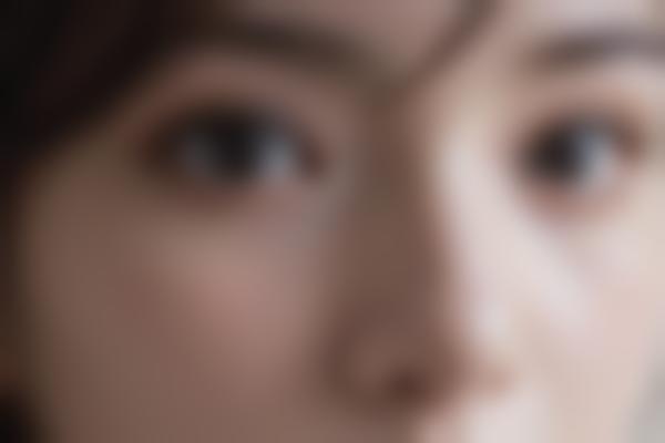 眼袋手术真的能让人年轻10岁吗？医生手术全过程