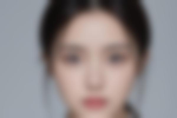 黑色素减少价格清单公开，快速了解黑色素减少需要多少钱！