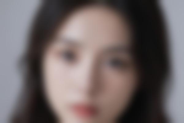 鼻型矫正有哪些方法？这几种常见方式需提前了解