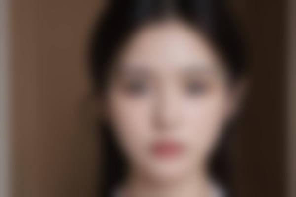 激光美容的常见误区