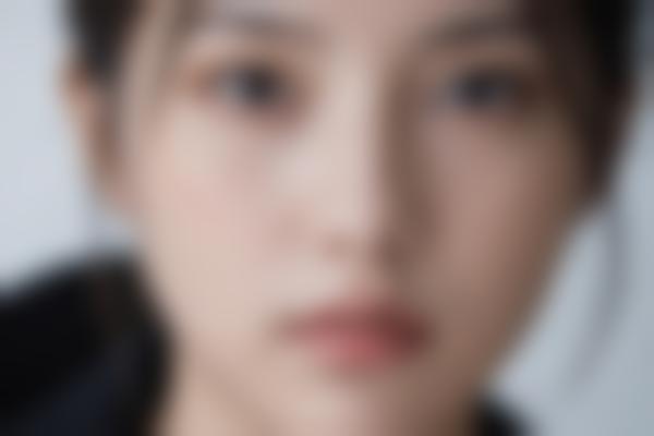 什么是绣线美容术？有效的抗衰新选择