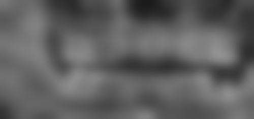 广州天河柏德口腔门诊部：仅需 1980 元，龈下刮治搞定牙周问题！ 