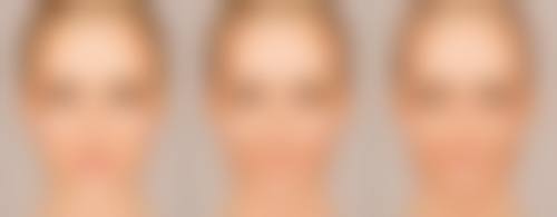 核心体验——脂肪干细胞修复疤痕