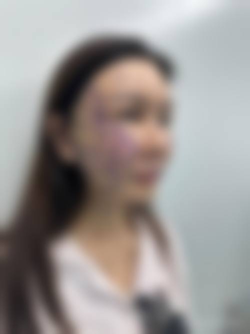 南京柏微医疗美容门诊部怎么样价格收费