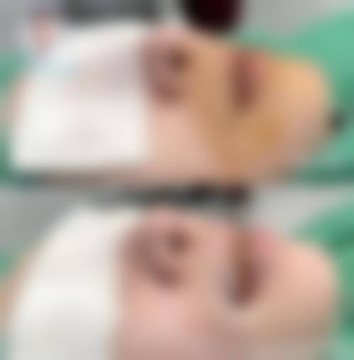 西安熹美整形医院怎么样特色项目及技术优势