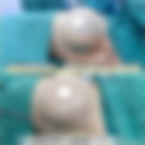 闫行医生的擅长领域