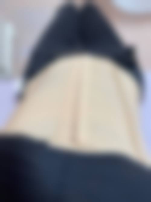 韩国体美人专精吸脂医院怎么样求美者反馈