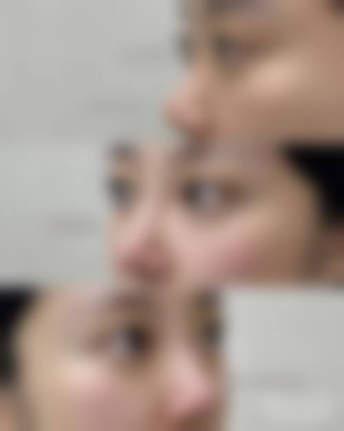 西宁澳丽医疗整形美容医院怎么样医生团队实力