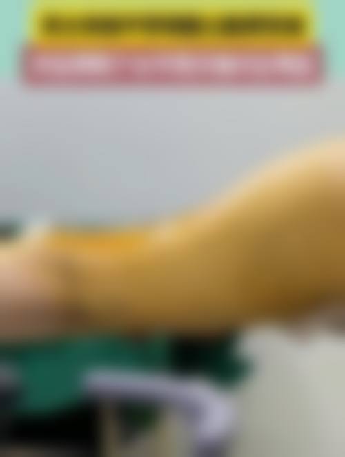 北京世纪坛医院整形美容科怎么样特色项目及技术优势