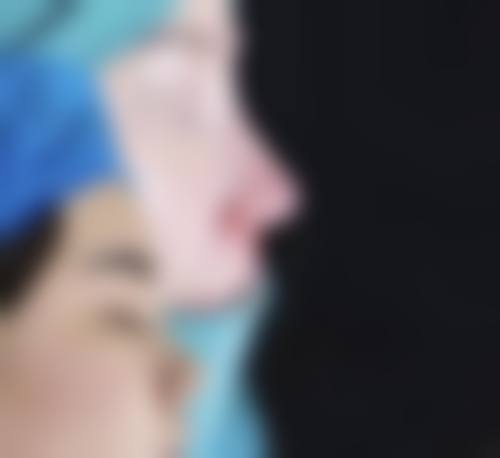 北京世纪坛医院整形美容科怎么样价格收费