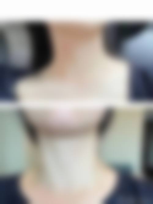 王秀娟医生的技术优势