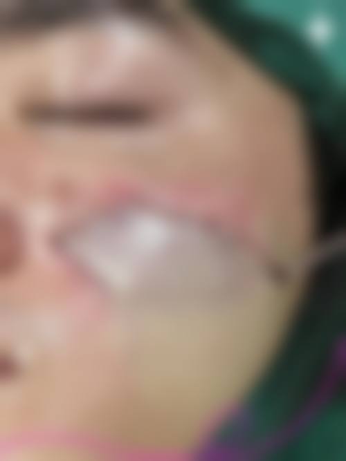 深圳鹏程植发怎么样医生团队实力