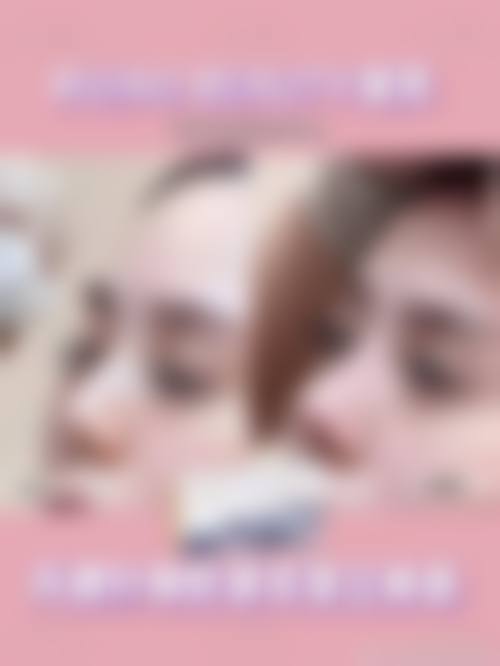 曹阿楠医生的技术特色