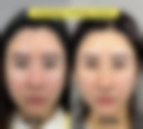 杨英医生的中医美容特色技术