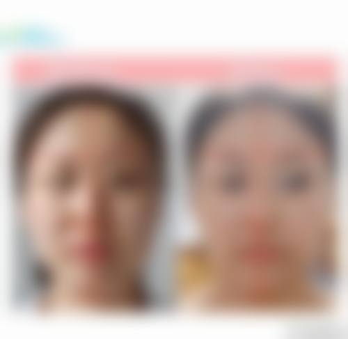 杨英医生的技术优势