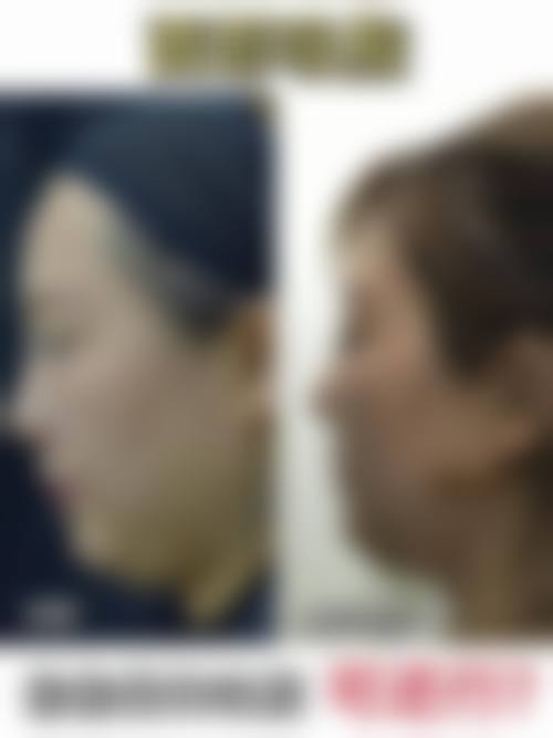 韩国体美人专精吸脂医院怎么样特色项目及技术优势