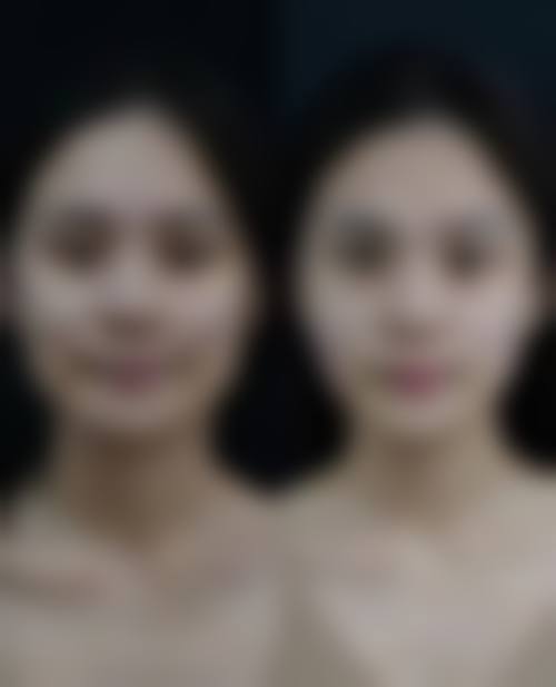 普罗菲耳整形外科怎么样求美者反馈