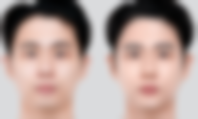 巫云医生的擅长项目