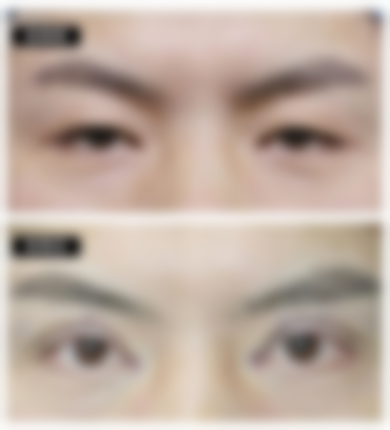 衡水诺美医疗美容诊所怎么样价格收费