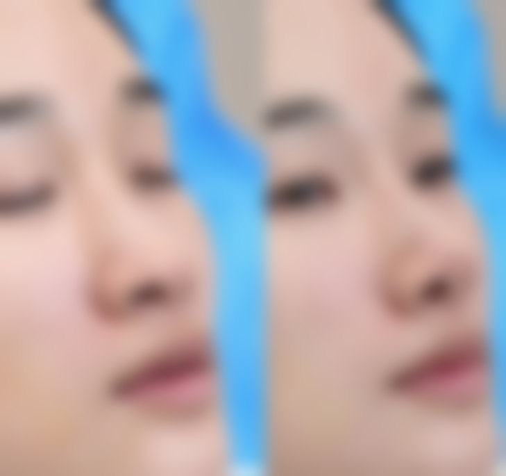 杨英医生的技术特色