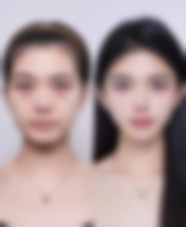 巫云医生的中医美容技术