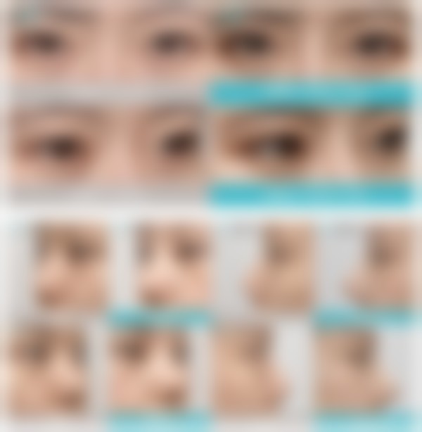 韩国来客like整形外科医院怎么样医生团队实力