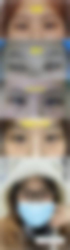 韩焱福医生的精良技术支持