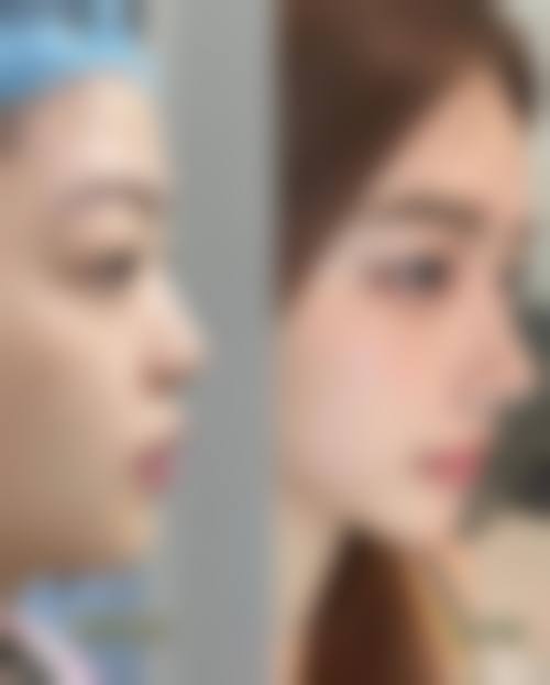 西安一芳华医疗美容诊所怎么样来院路线