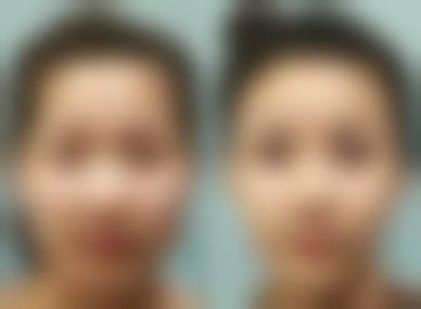 晋中莺华整形美容医院怎么样简介概述