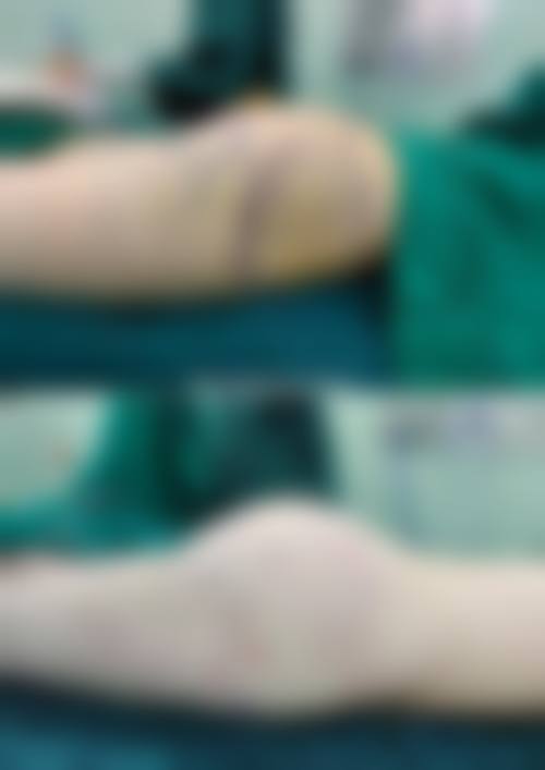 蚌埠市第三人民医院(烧伤整形科)怎么样求美者反馈