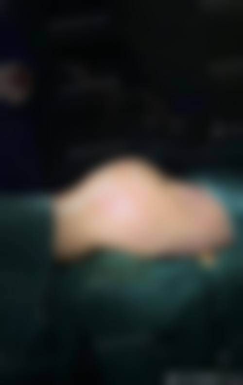 蚌埠市第三人民医院(烧伤整形科)怎么样价格收费