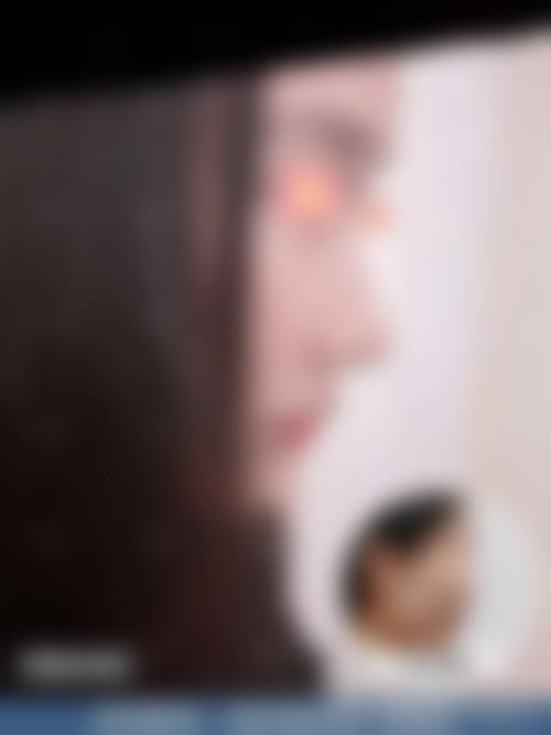 札幌Dream美容外科怎么样价格收费