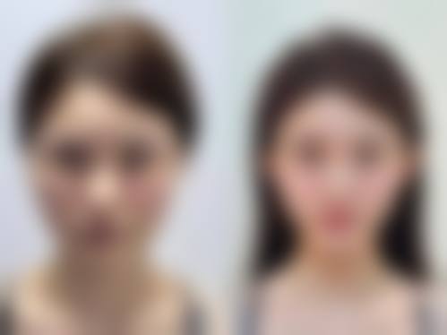 梅爱任医生的医美技术优势