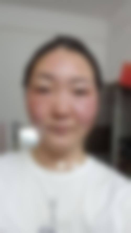 曹阿楠医生的技术优势