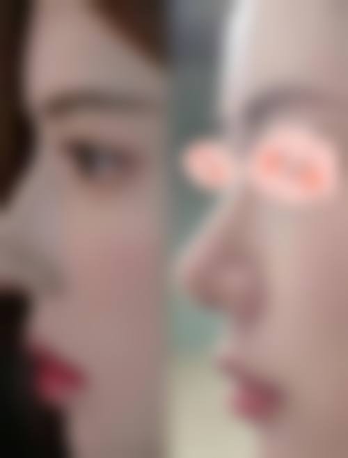 昆明璀璨人生医疗美容诊所怎么样求美者反馈