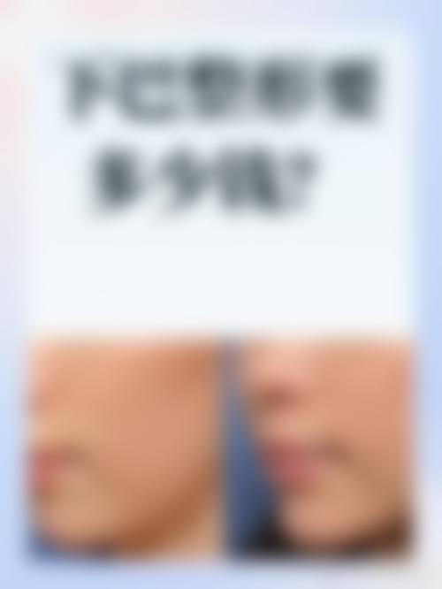 梅爱任医生的价格与服务