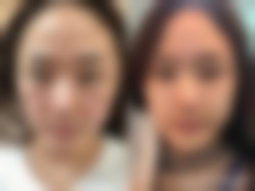 日照岚山区妇幼保健站整形科怎么样求美者反馈