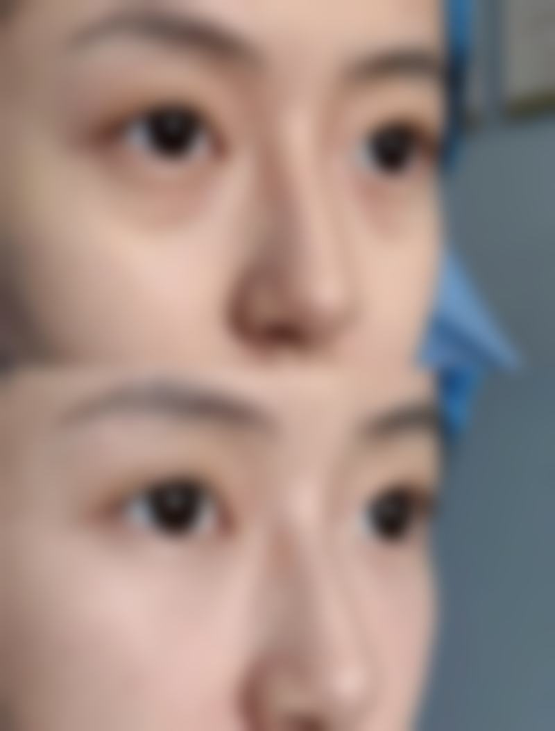 巫云医生的特色中医美容技术