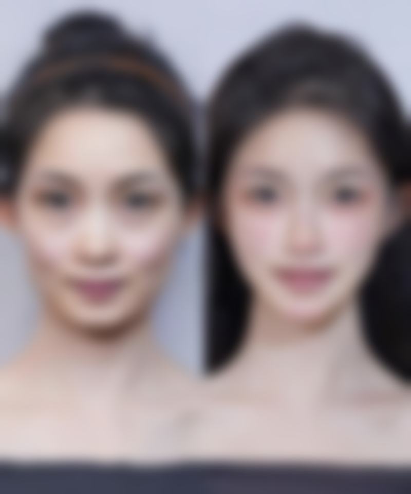 北京京都时尚整形美容医院怎么样特色项目及技术优势