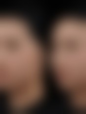 晋中莺华整形美容医院怎么样求美者反馈