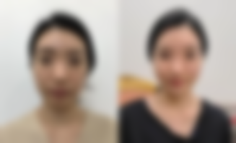 晋中莺华整形美容医院怎么样价格收费