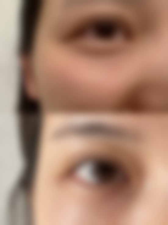 闫行医生助您实现美丽蜕变