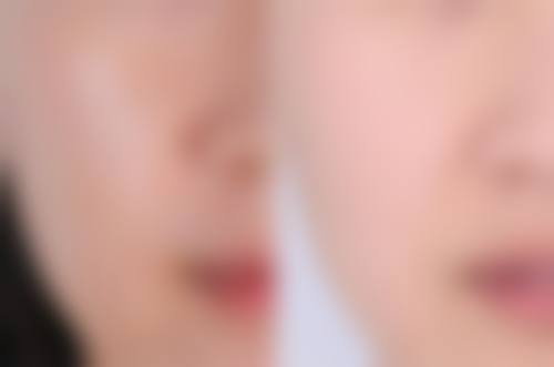 西安多美美诺医疗美容诊所怎么样求美者反馈